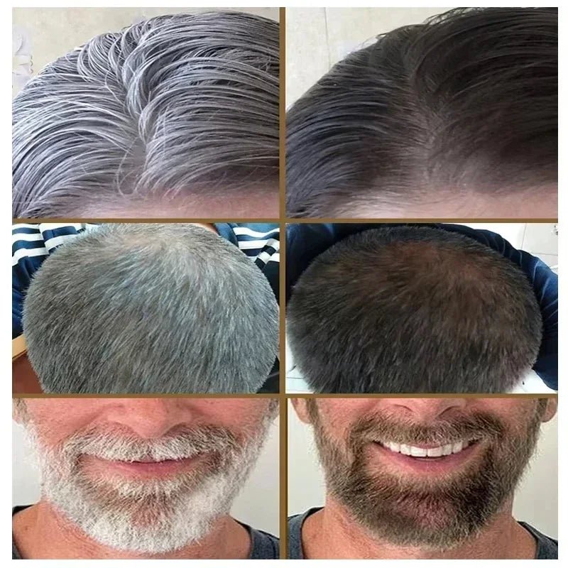 Gray Hair Color Treatment for Restoring Natural Looking Hair